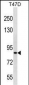 ZNF43 Antibody(N-term)