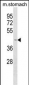 COLQ Antibody(C-term)