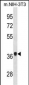 Mouse Fgf8 Antibody(N-term)