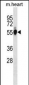 Mouse Gpi Antibody(C-term)