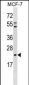 EBP Antibody(C-term)