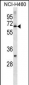 ZNF185 Antibody(N-term)