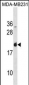 LGALS7 Antibody(Center)