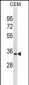 PRPS1L1 Antibody(N-term)