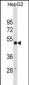 TUBG1 Antibody(N-term)