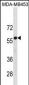 UGT2B4 Antibody(N-term)