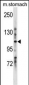 LRIG1 Antibody (C-term)