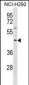 TXNIP Antibody(N-term)