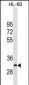 MMP26 Antibody (Center)