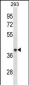 ACAA1 Antibody (Center)