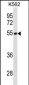 TES Antibody (N-term)