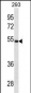 LGMN Antibody (N-term)