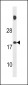 SPNXB Antibody (Center)