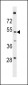 T161A Antibody (N-term)