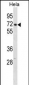 CPSF6 Antibody (N-term)