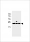 TMEM199 Antibody (N-term)