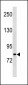 PLOD2 Antibody (C-term)