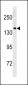 PCDH11Y Antibody (C-term)