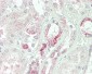 C1GALT1 Antibody (Center)