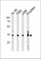 GFI1B Antibody (C-term)