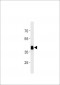 DANRE hoxc11a Antibody (N-term)
