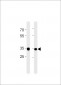 RPLP0P6 Antibody (N-term)