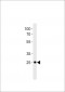 DANRE dlx6a Antibody (C-term)