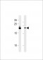 FAM216B Antibody (C-term)