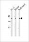 PSMB2 Antibody (C-term)