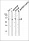 CIR Antibody (N-term)