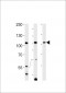 TFIP11 Antibody (N-term)