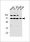 GABRQ Antibody (C-term)