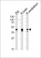R Csnk2a1 Antibody (N-term)