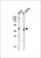 KHDRBS2 Antibody (C-term)