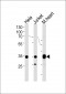 NDUFA9 Antibody (Center)