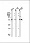 PIP5KL1 Antibody (N-term)