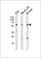 CCDC36 Antibody (C-term)
