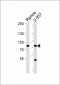 ZC3H11A Antibody (N-term)