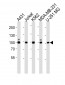ZNF175 Antibody (N-term)
