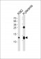 HBG2 Antibody (C-term)