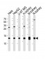 NDUFC2 Antibody (N-term)