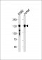 PHKB Antibody