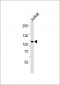 SART1 Antibody