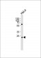 NDUFV2 Antibody