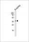 SCDGFB Antibody (Center)