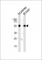 Mouse Csnk1g3 Antibody (C-term)