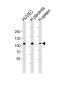 GP1BA(Glycocalicin) Antibody (Center)