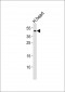 NDUFV3 Antibody