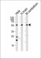 PFTK1 Antibody (N-term)