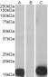 Psoriasin / S100A7 Antibody (internal region)